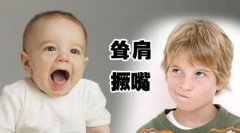 小儿抽动症应该如何治疗
